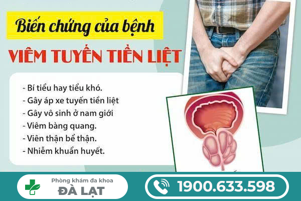 Hình ảnh minh họa